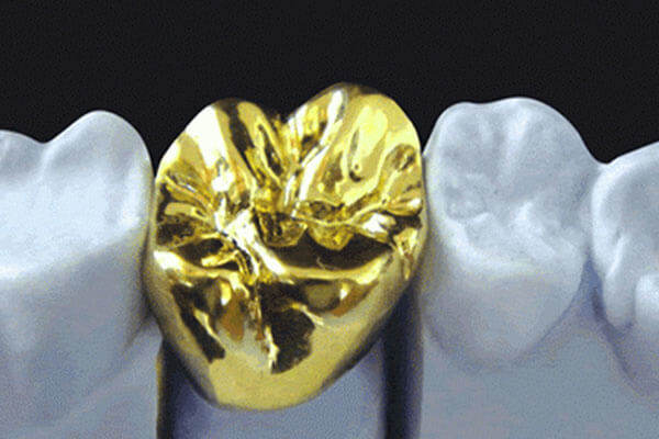 Gold dental crowns