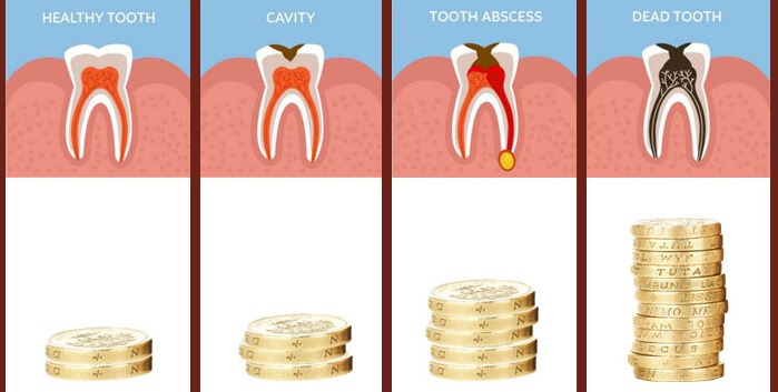 Preventative Dental care is cheaper, illustrations showing increasing costs of dental neglect