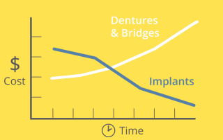 cost of dental implants compared to dentures graph