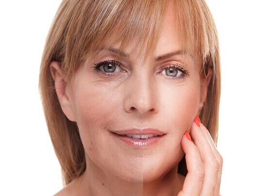 Botox FAQs, mature woman showing effects of Botox on half of her face