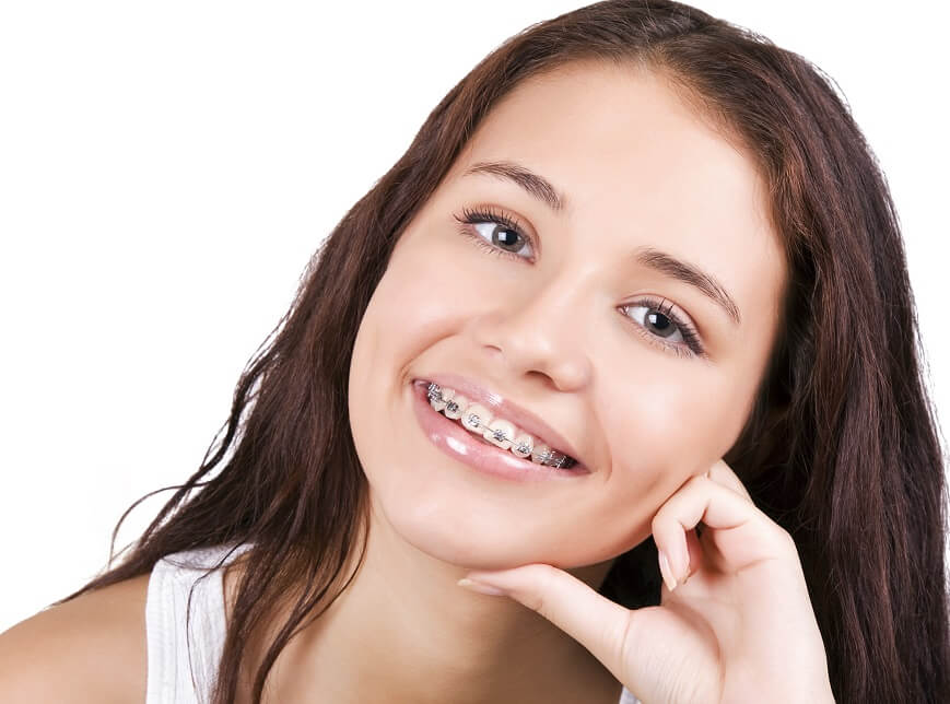 Covid orthodontic delays, braces