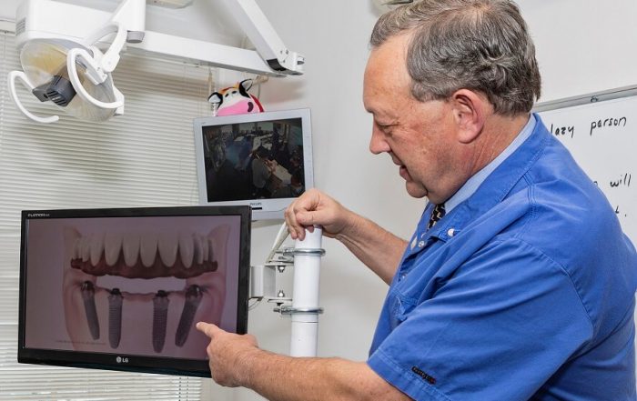 Dental implants, alternative to dentures, dentist showing dental implant diagram