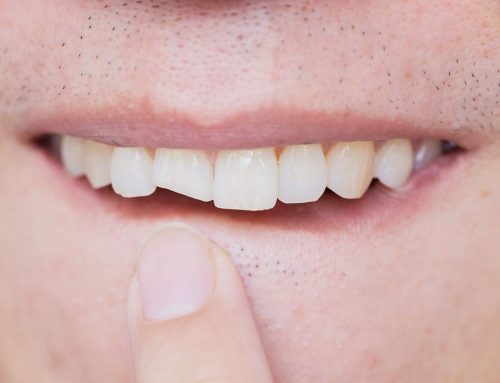 What Is A Dental Emergency?