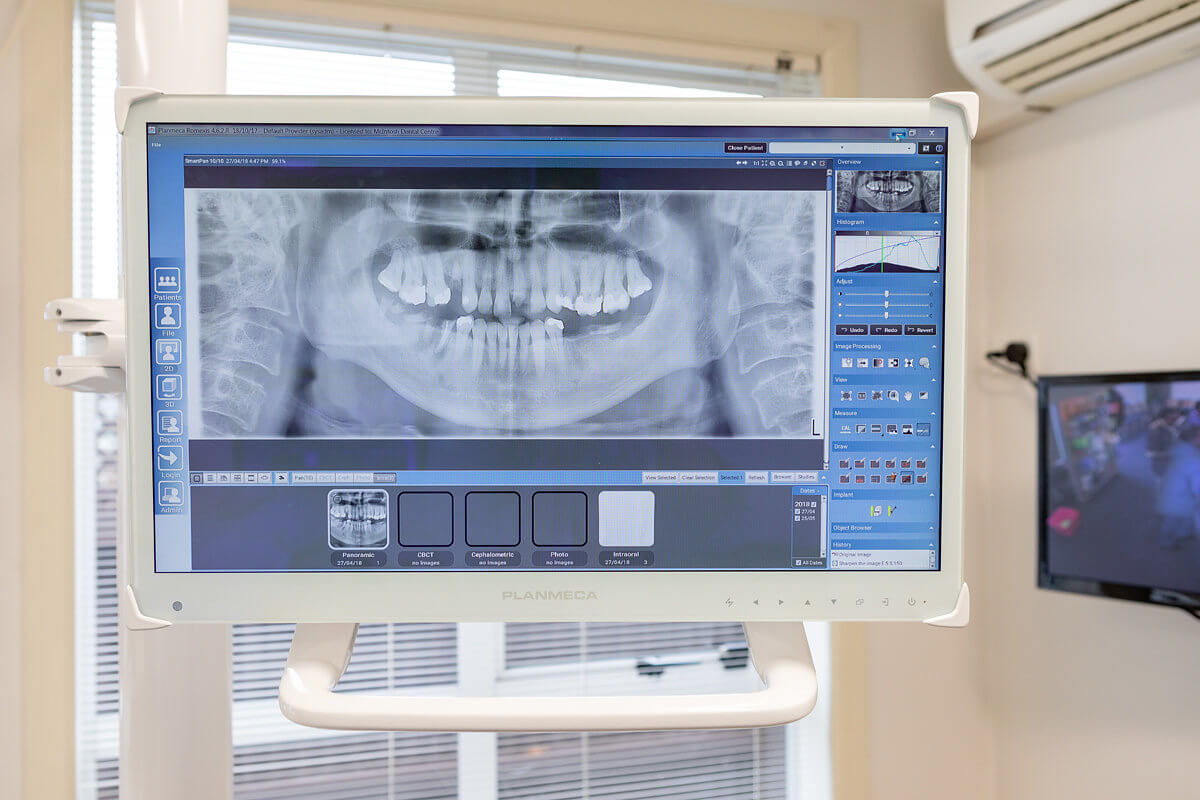 McIntosh-Dental_Blurred patient name dental check up
