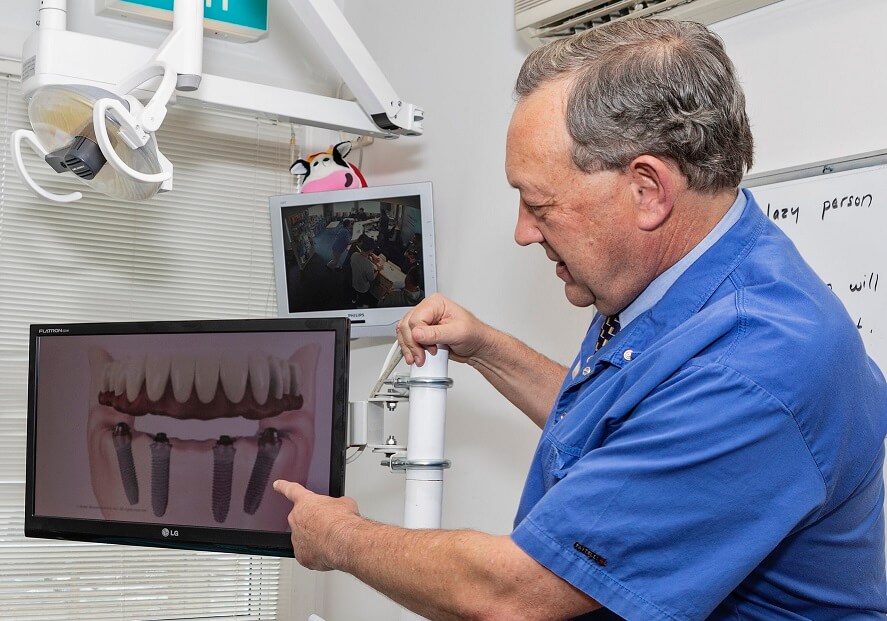 Dental implants, alternative to dentures, dentist showing dental implant diagram