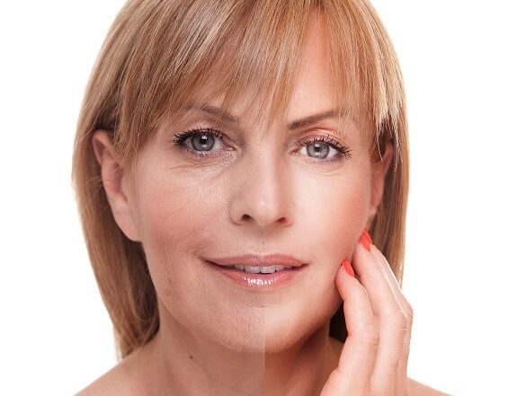 Botox FAQs, mature woman showing effects of Botox on half of her face