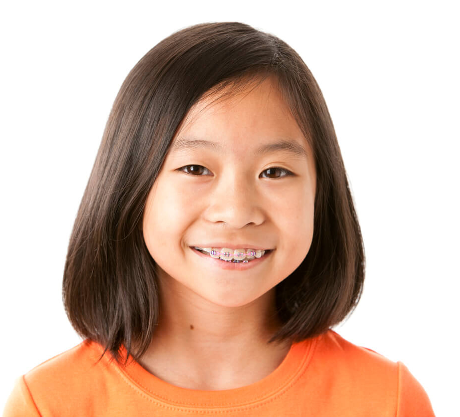 Auckland childrens orthodontics