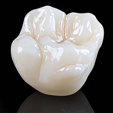 hobsonville dental crowns